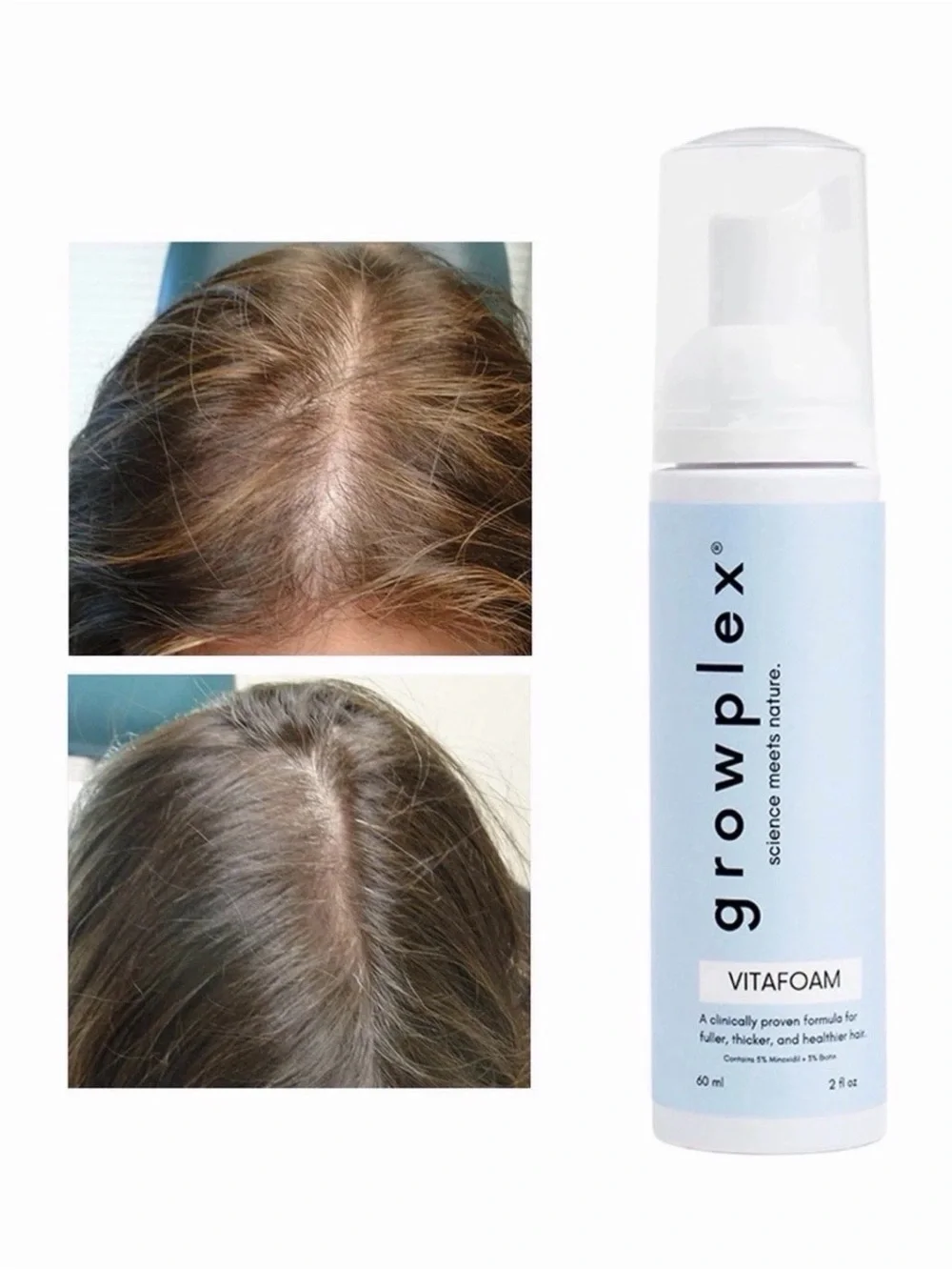 GROWPLEX Vitafoam 5% Minoxidil Foam for Hair Regrowth - 2 fl oz *NEW SEALED*